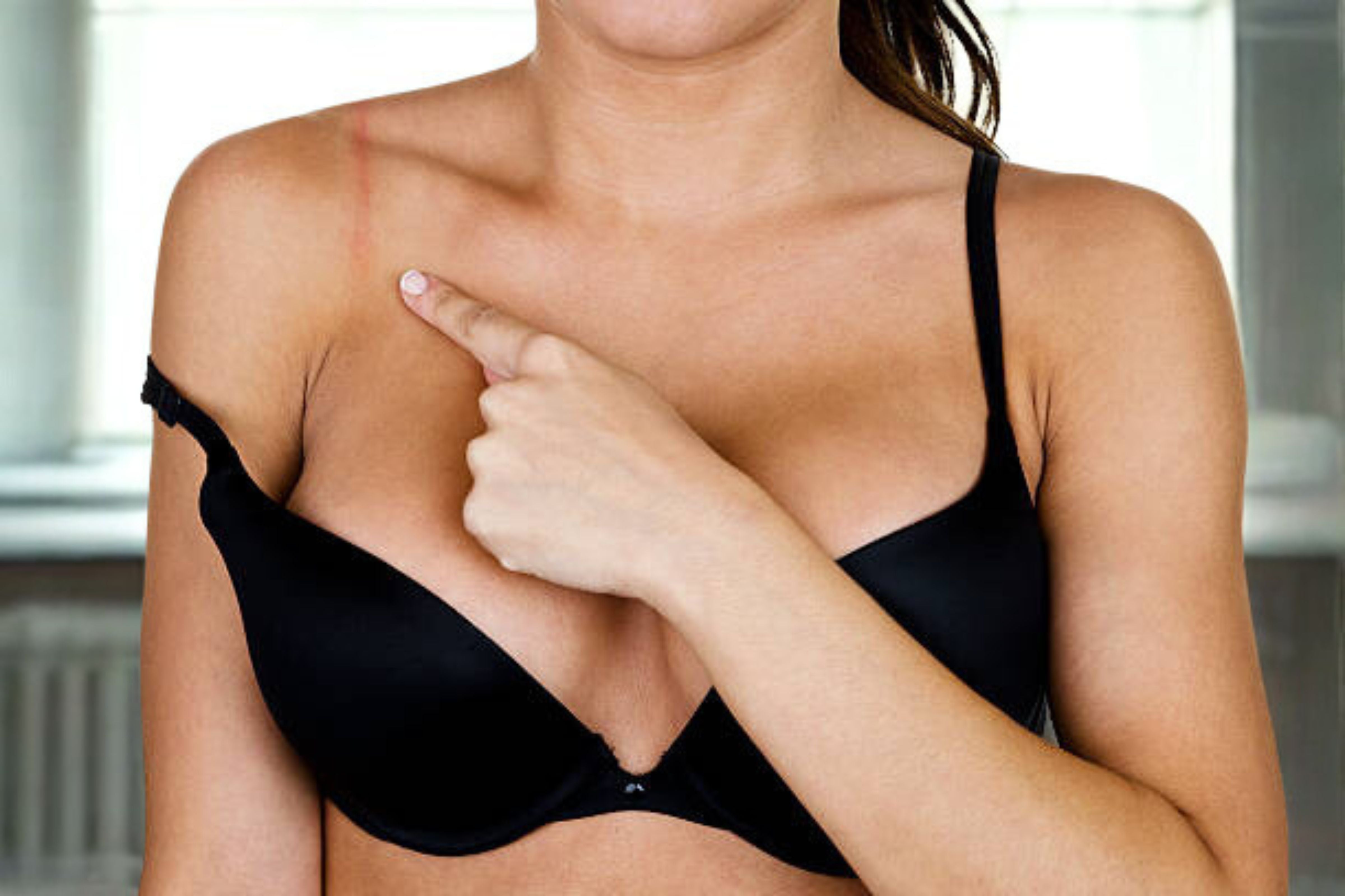 Why do my bras leave red marks?
