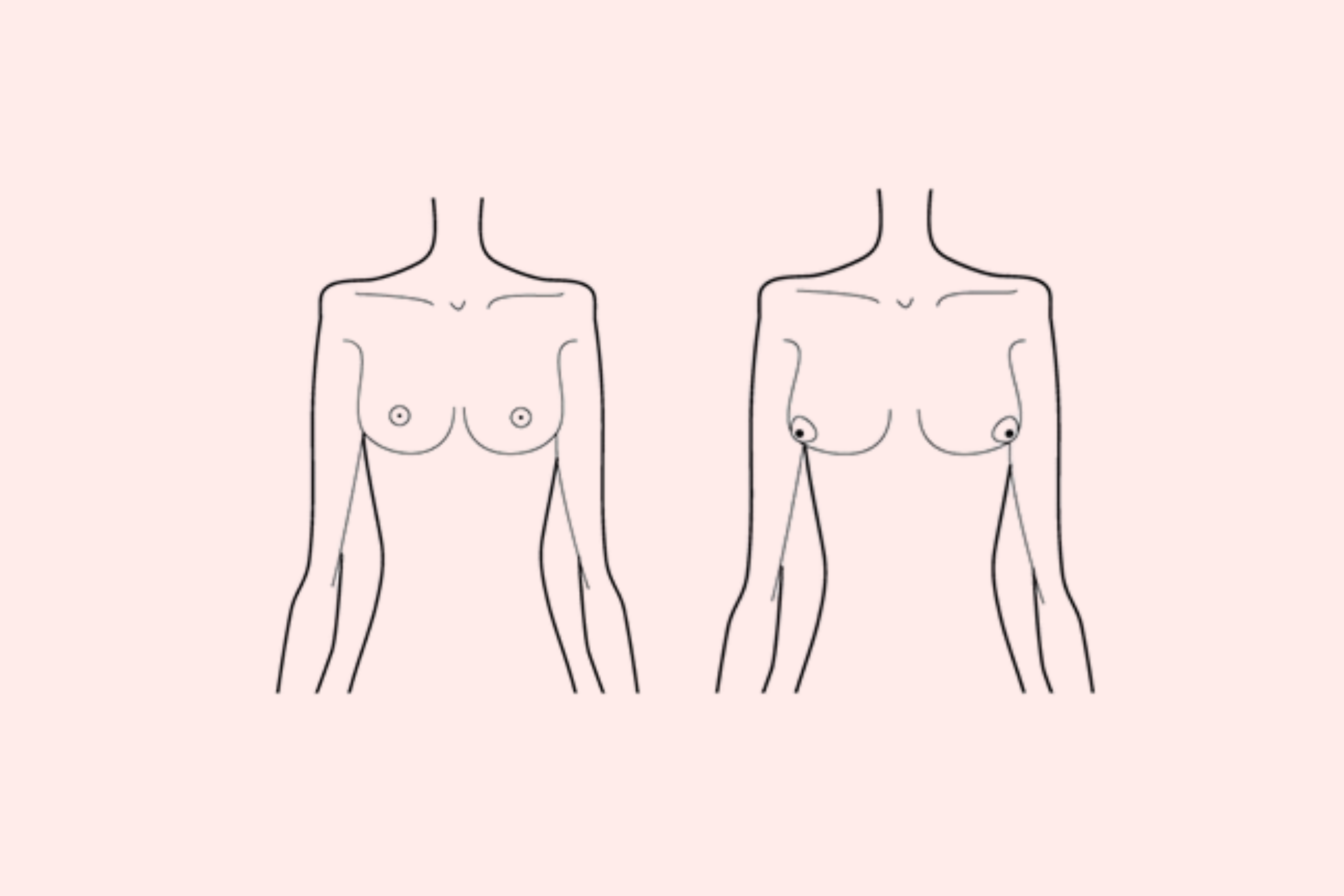 5 Types of Boobs