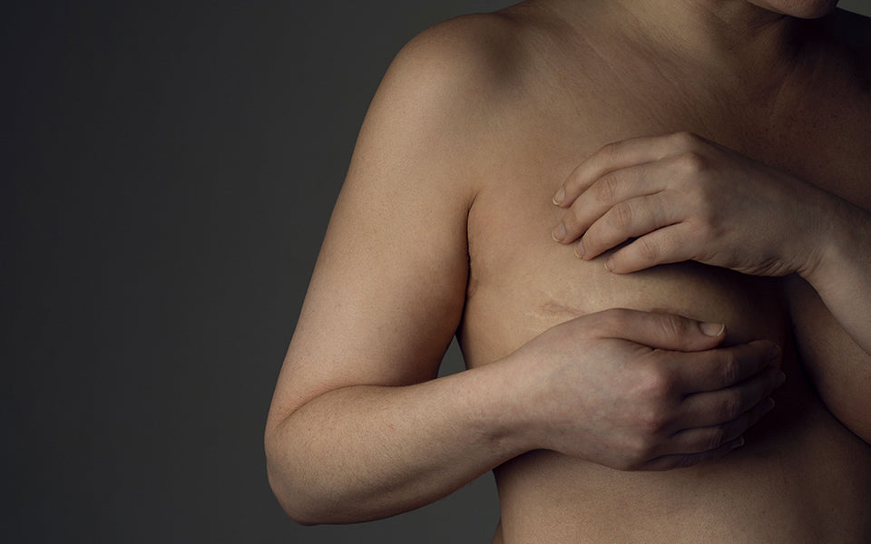 How many ways to Treat Your Breast Reduction Scars