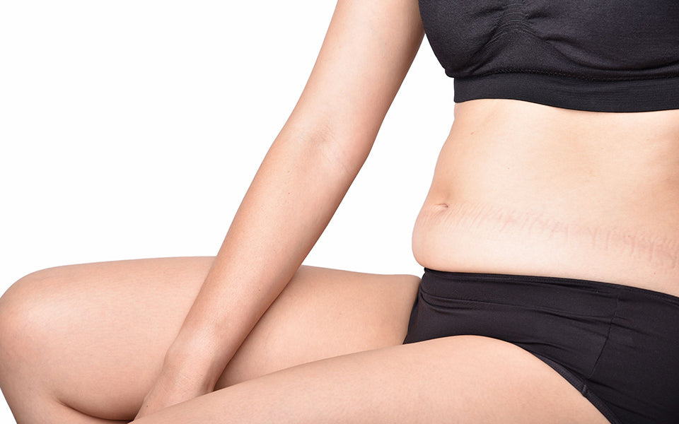 What Is a Muffin Top?