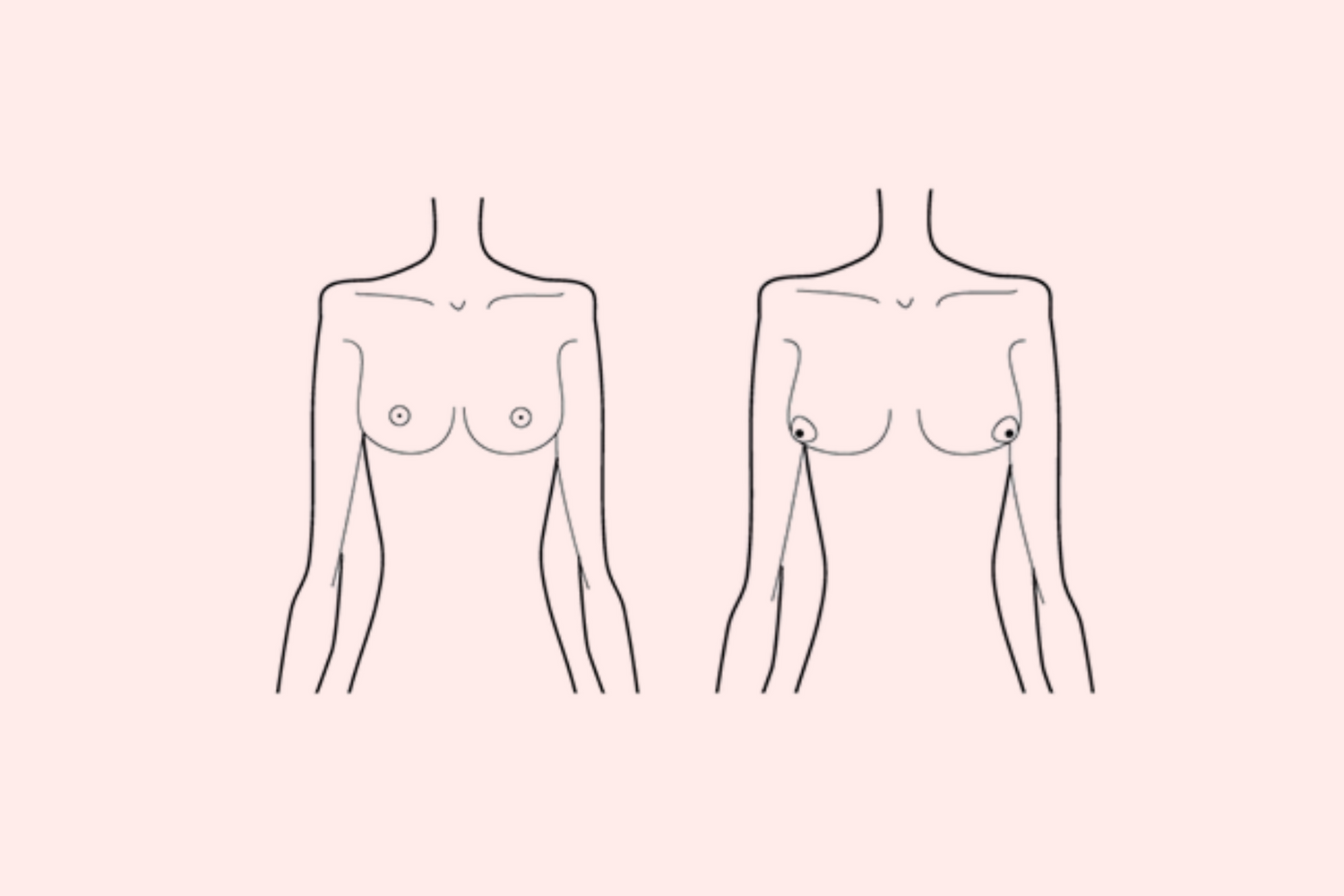 5 Types of Boobs