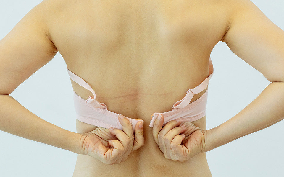 Bra Abrasion: What It Is and How to Treat It